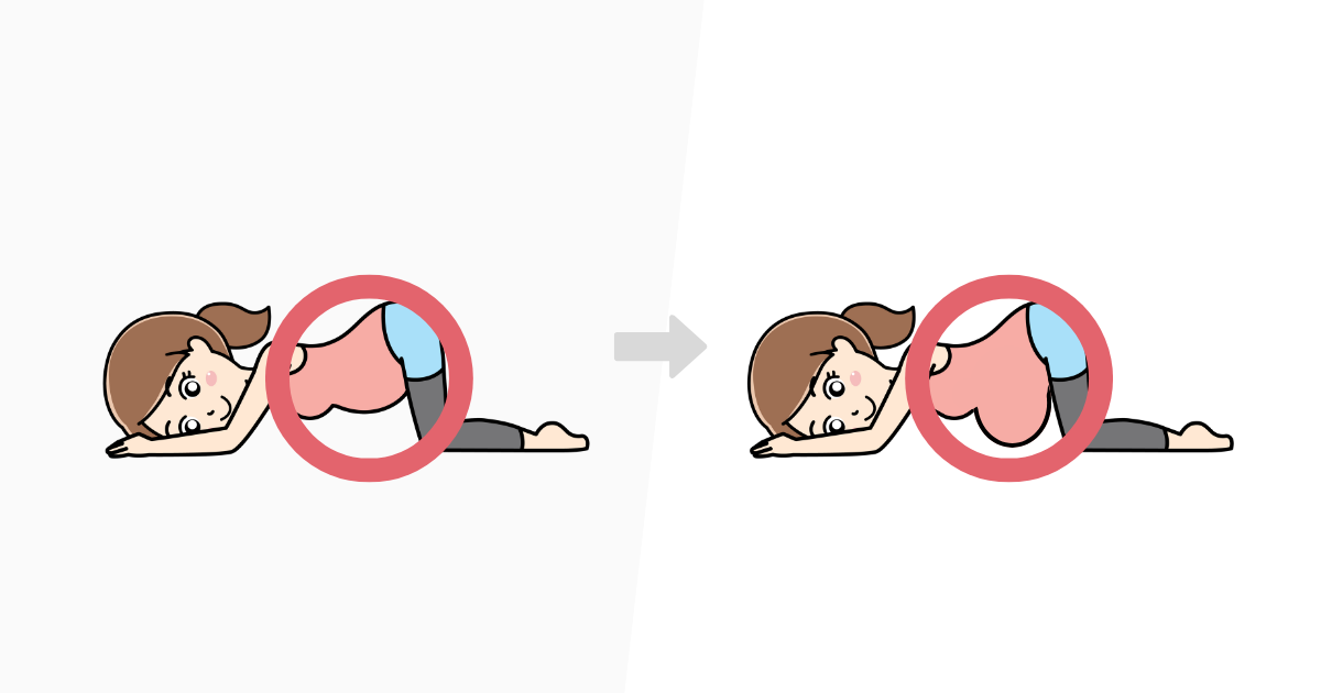 逆子体操中の子宮