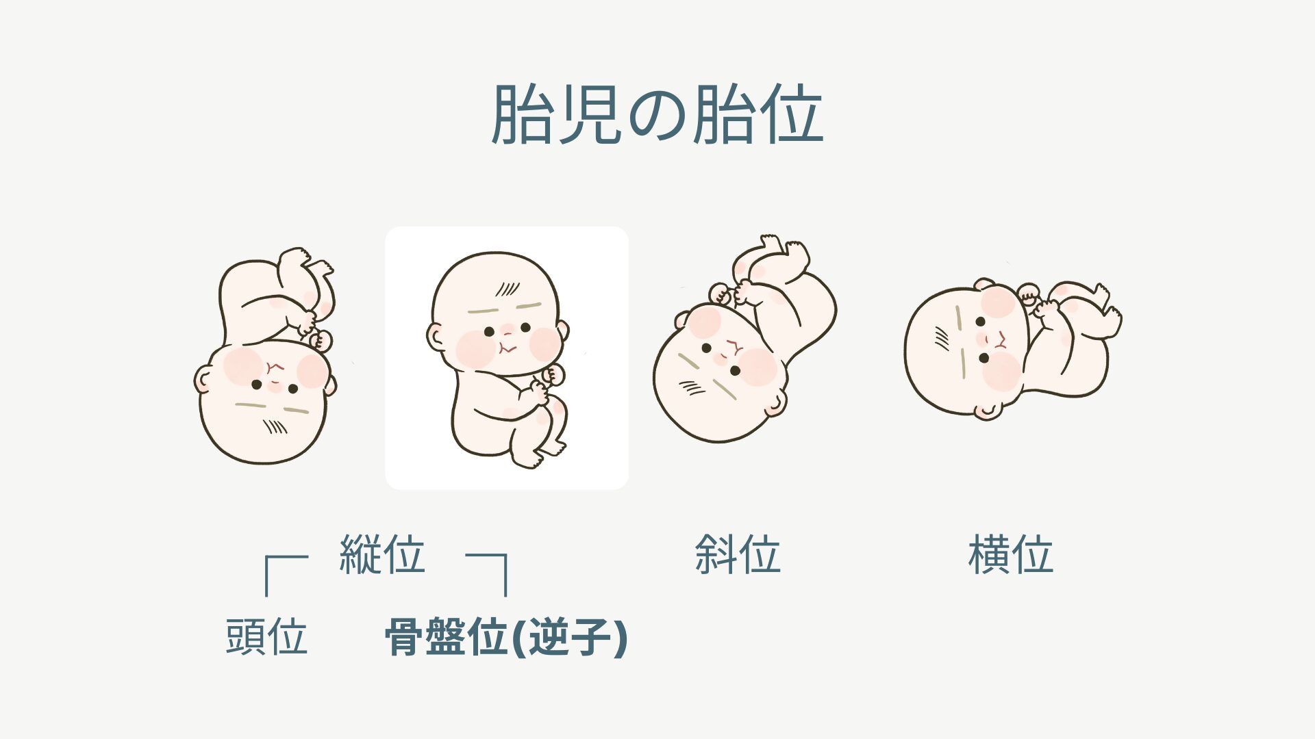 胎児の胎位